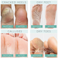 Exfoliating Callus Remover exfoliating foot peel mask